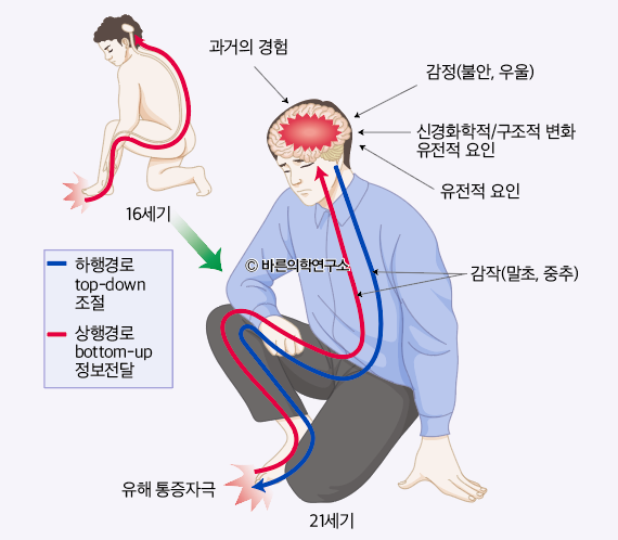 통증이란 무엇인가? - Metamedic