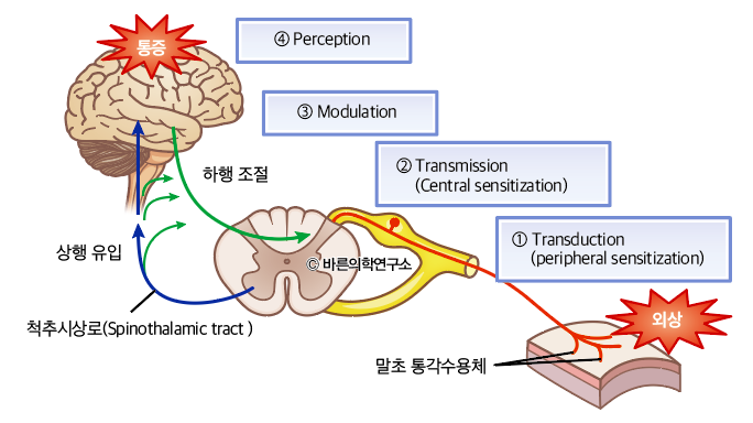 통증이란 무엇인가? - Metamedic