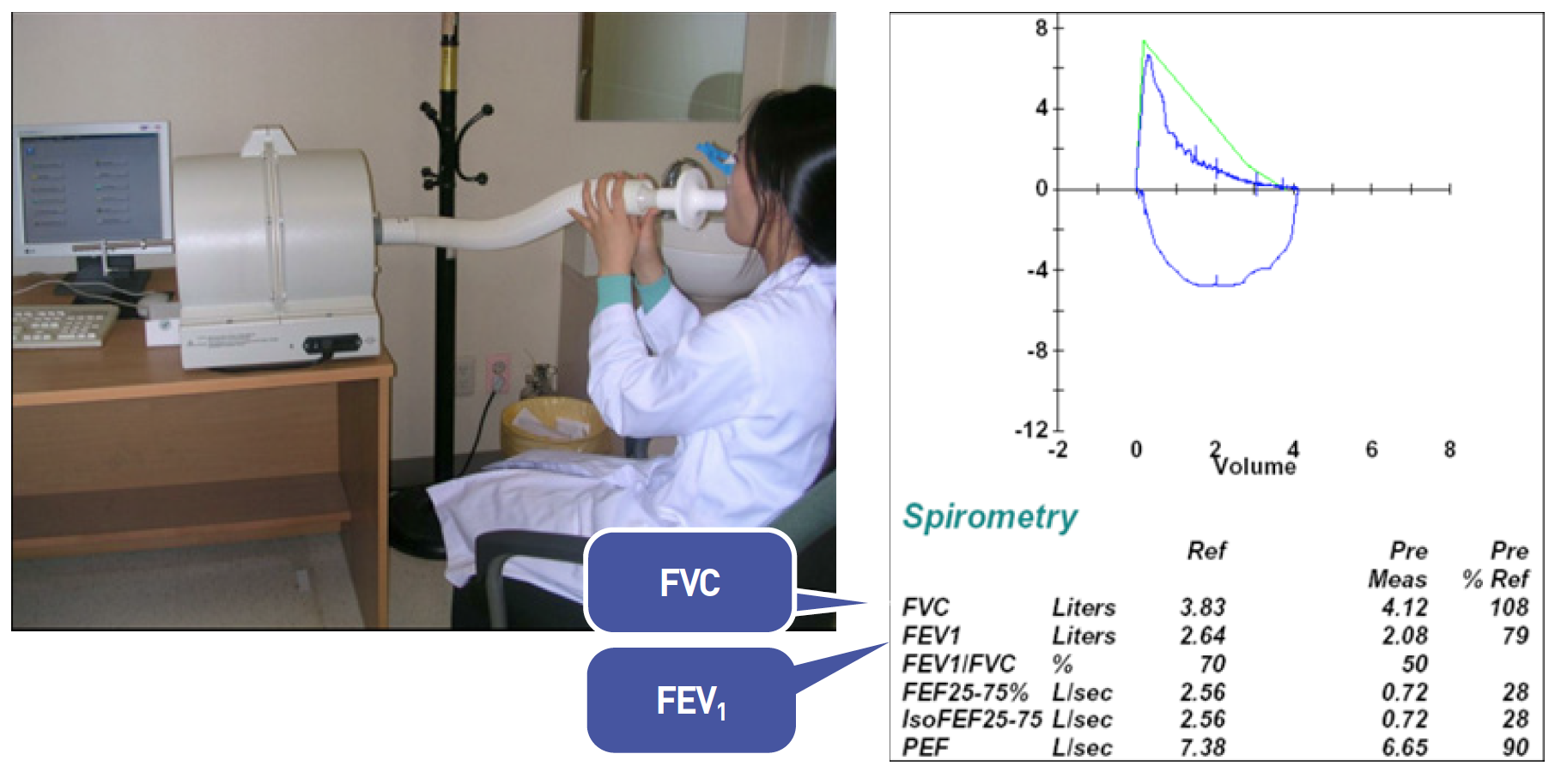 폐기능검사 Metamedic