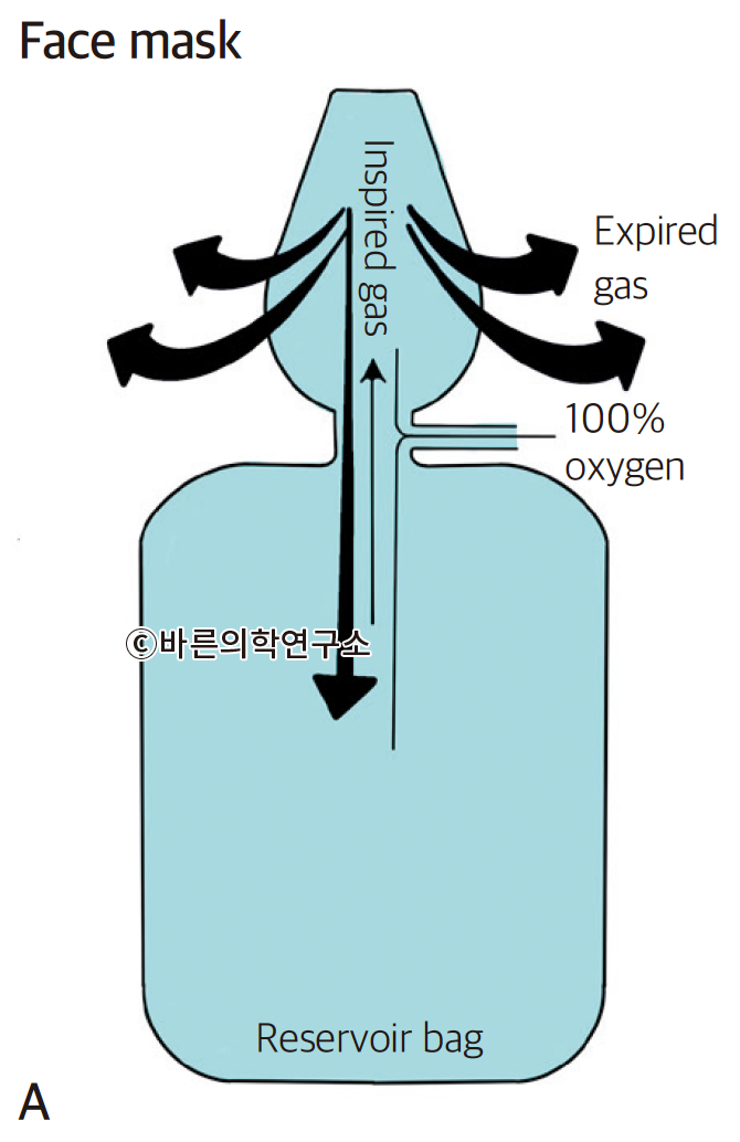산소요법: 개요 - Metamedic