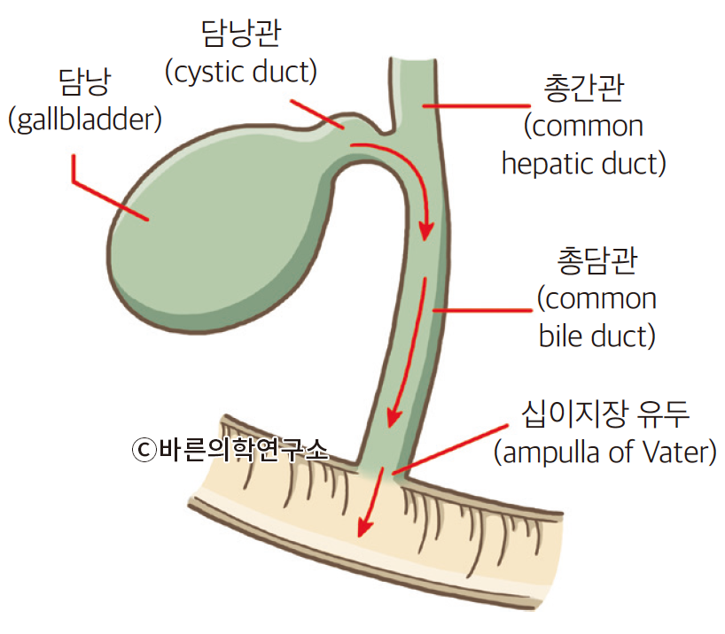담석 질환(Gallstone) - Metamedic