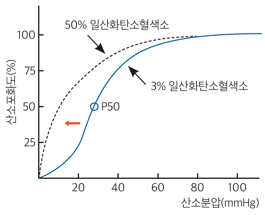 일산화탄소(Carbon monoxide) 중독 - Metamedic