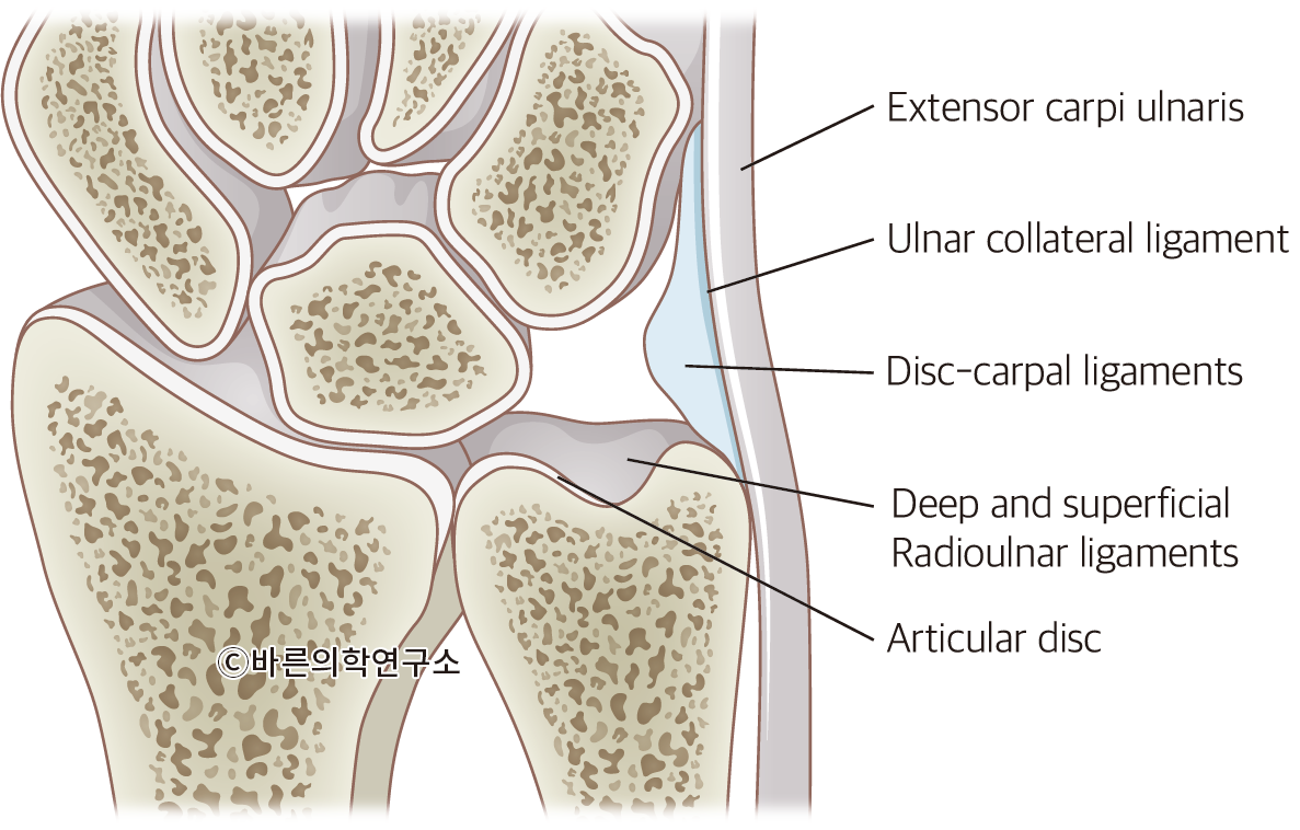 삼각 섬유연골 복합체 손상(Triangular fibrocartilage complex tear) - Metamedic