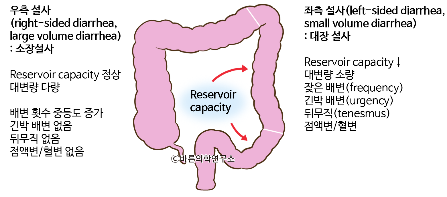 만성설사(Chronic diarrhea) - Metamedic